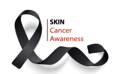 Skin Cancer Awareness and Prevention