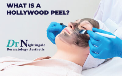 What is a Hollywood Peel?